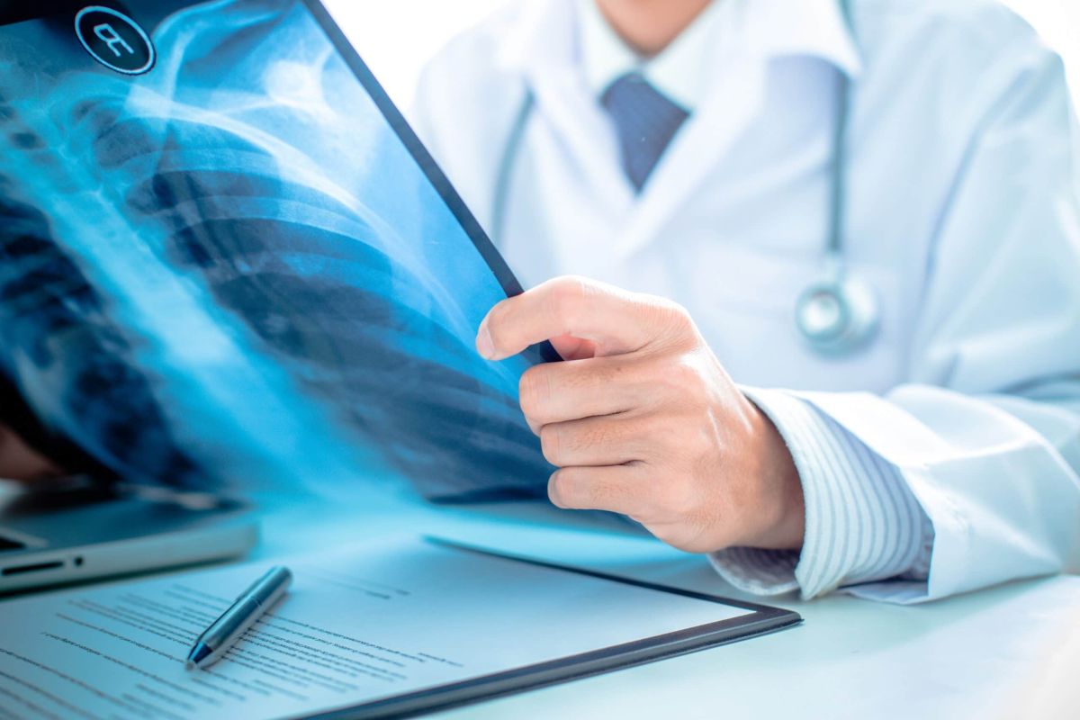 doctor second opinion